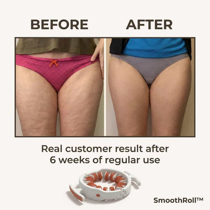 SmoothRoll 360-graden cellulitemassager