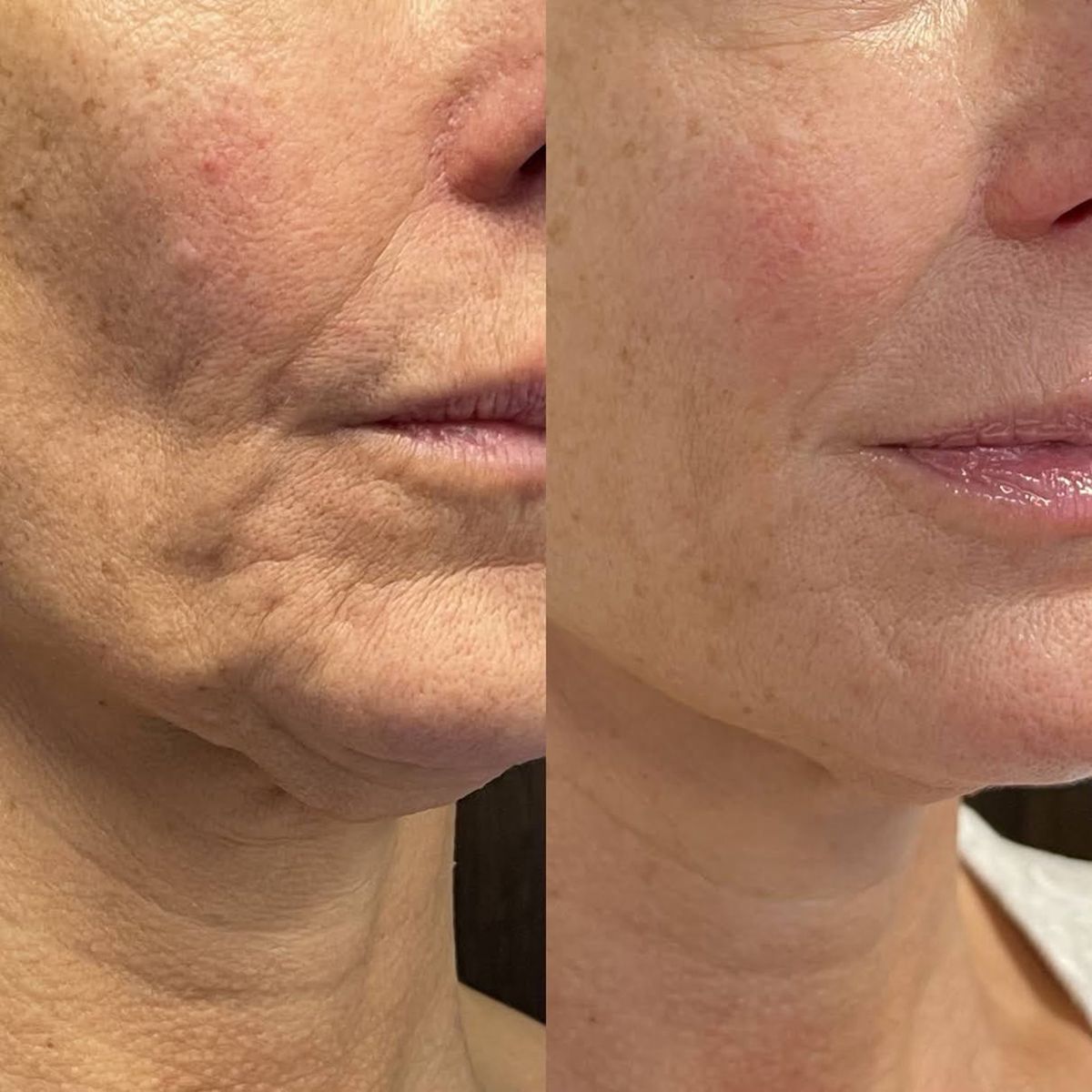 Nectare Anti-Aging Serum Stick
