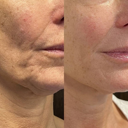 Nectare Anti-Aging Serum Stick