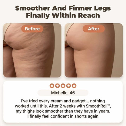 SmoothRoll 360-graden cellulitemassager