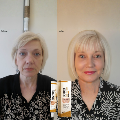 Apiluxe Bijengif anti-aging jeugdcrème