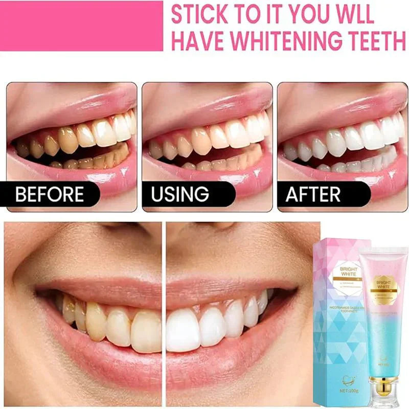 BrightMolto probiotische whitening tandpasta
