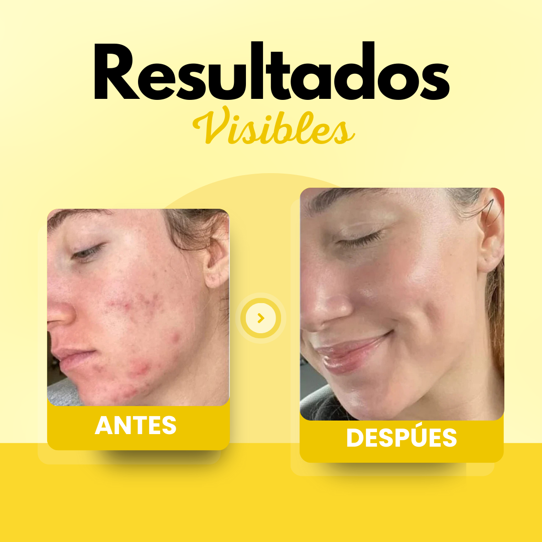 Dermaluxe hydraterende crème