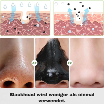 PealClean™ actieve kool peel-off masker