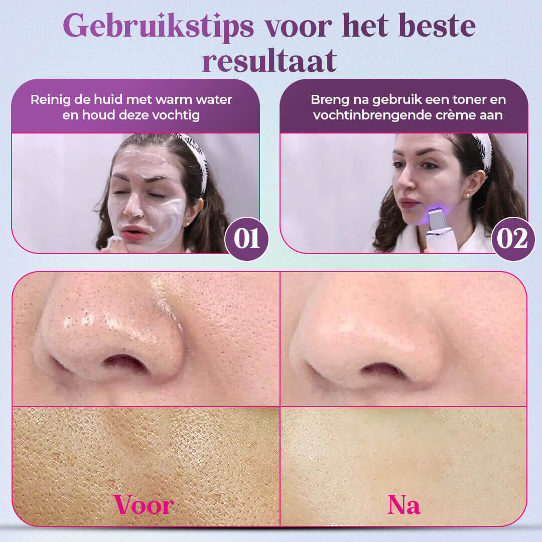 DermaSonic Pro ultrasone gezichtsreiniger