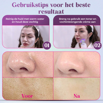DermaSonic Pro ultrasone gezichtsreiniger