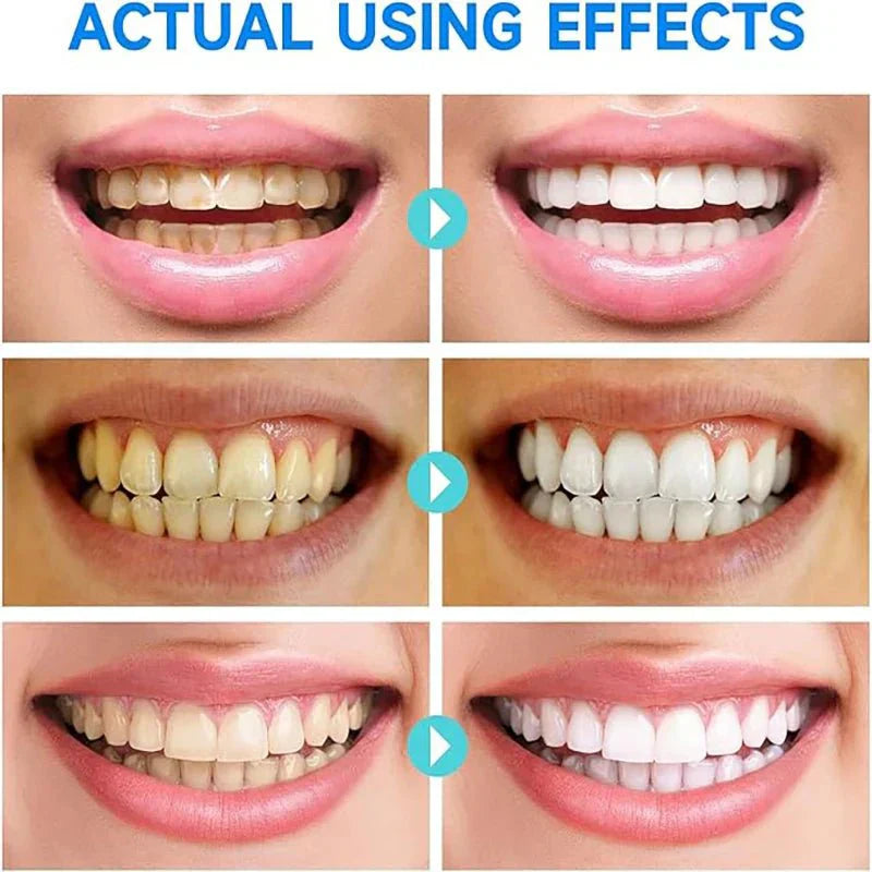 BrightMolto probiotische whitening tandpasta