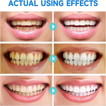 BrightMolto probiotische whitening tandpasta