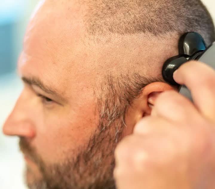 SmoothTrim 5-in-1 multifunctionele precisietrimmer