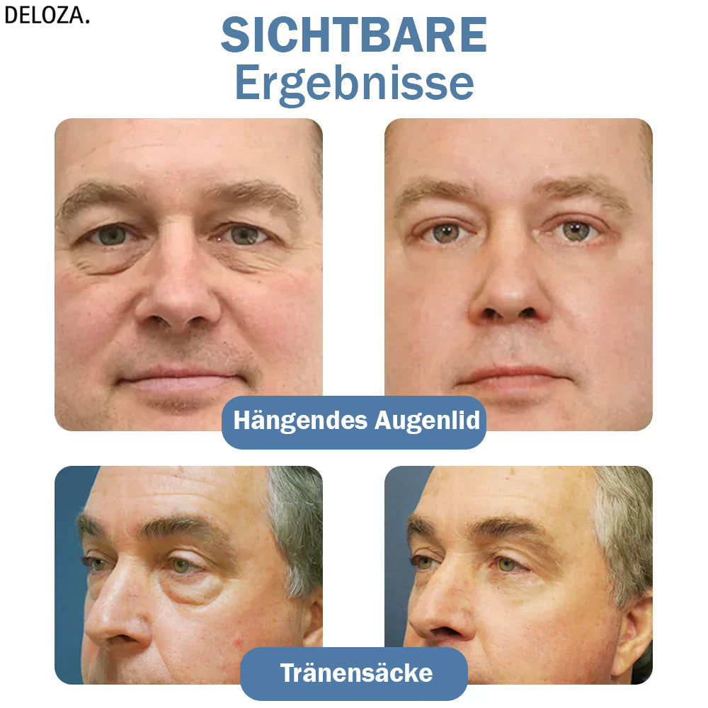 EyeTouch Lifting Oogengel
