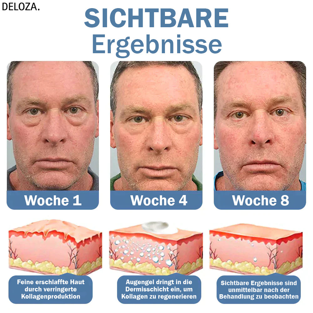EyeTouch Lifting Oogengel