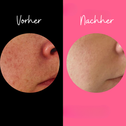 RadiantSkin zachte peeling spons
