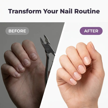 SmartTrim 2-in-1 elektrische nagelknipper en polijster