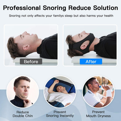 DreamQuiet anti-snurk kinband