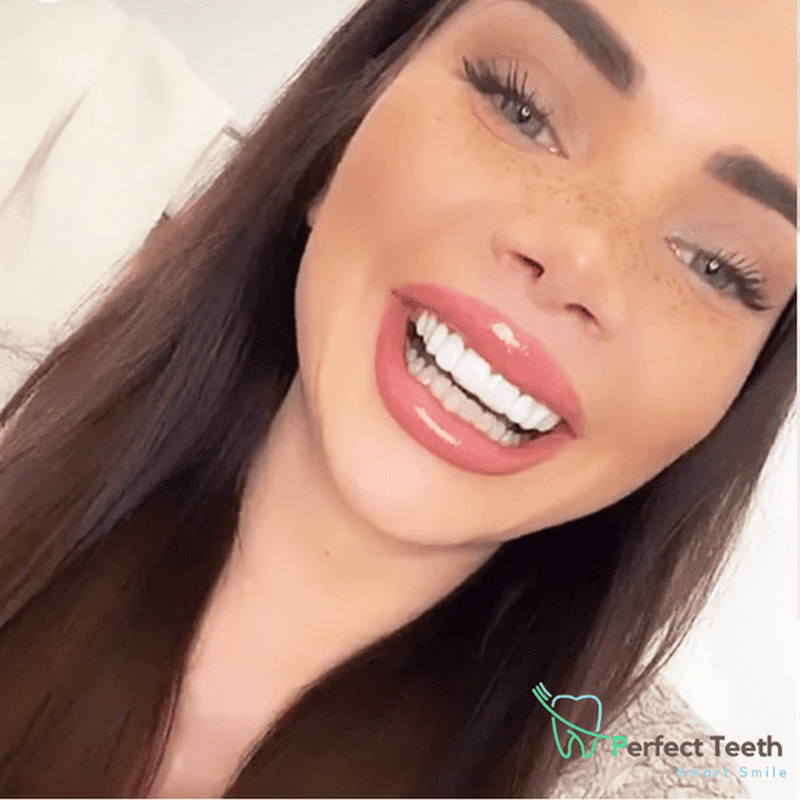 Smart Smile cosmetisch gebit