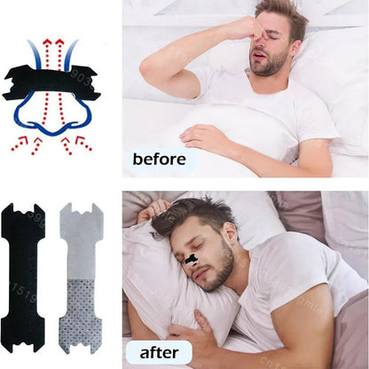 AIRWAYCARE anti-snurk neusstrips