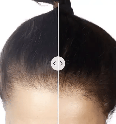 ChicBlend 5-in-1 massage haarkam