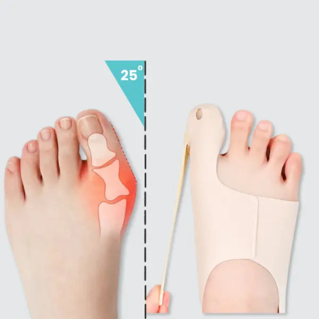 Hallux Corrector Mouw
