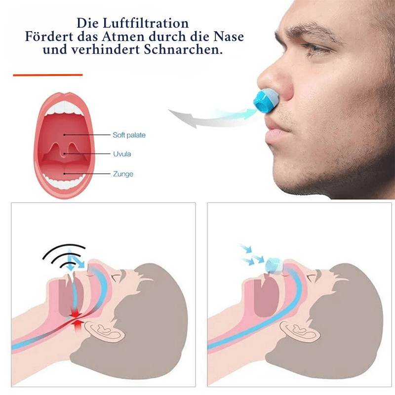 Sleeppure anti-snurk luchtfiltersysteem