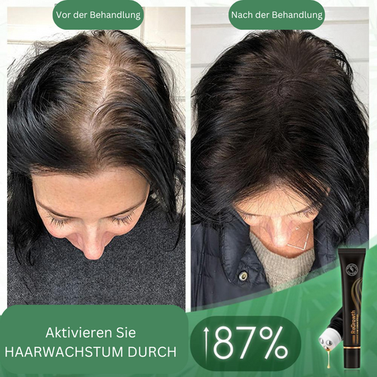Regrowth™ biologische haarserum-roller