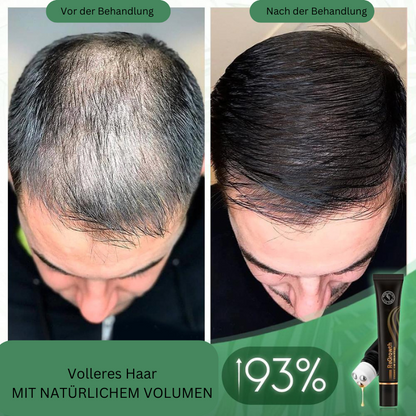 Regrowth™ biologische haarserum-roller