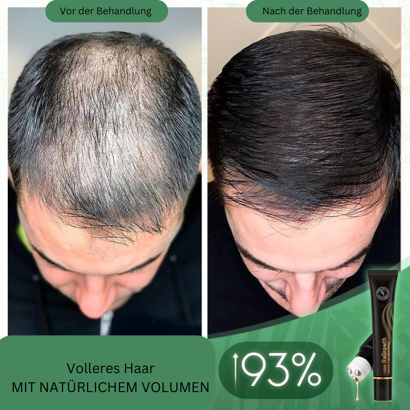 Regrowth™ biologische haarserum-roller