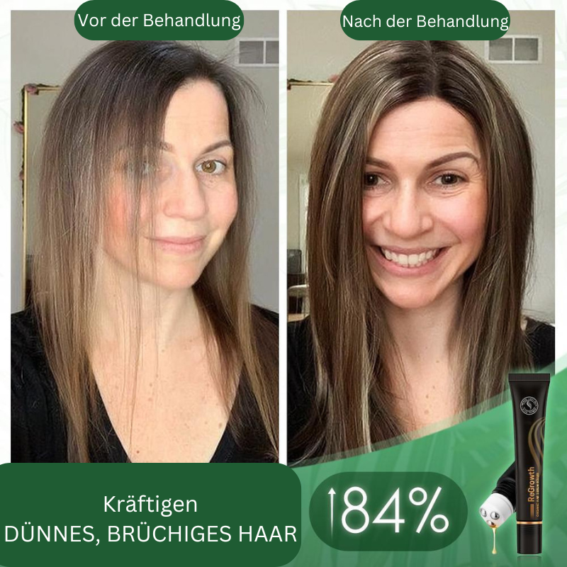 Regrowth™ biologische haarserum-roller