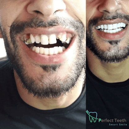 Smart Smile cosmetisch gebit