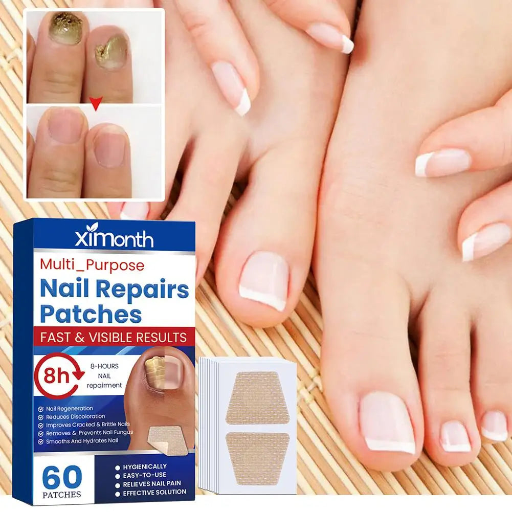 HealthyNail schimmelnagel herstelpleisters
