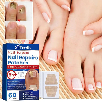 HealthyNail schimmelnagel herstelpleisters