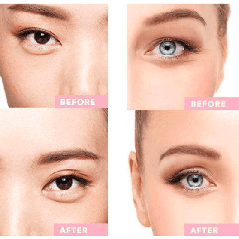 Dream Eyes Instant oogcorrectie strips