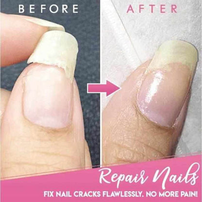Gescheurde nagel reparatie gel