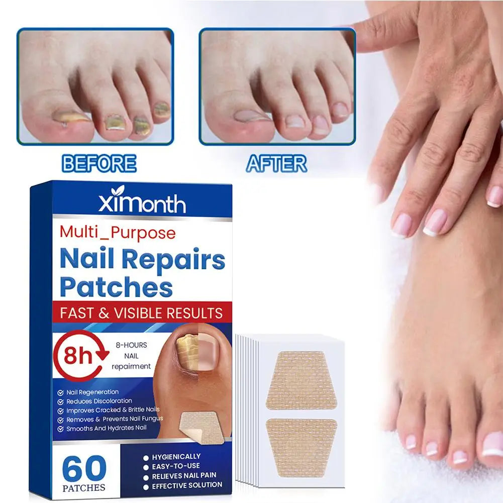HealthyNail schimmelnagel herstelpleisters