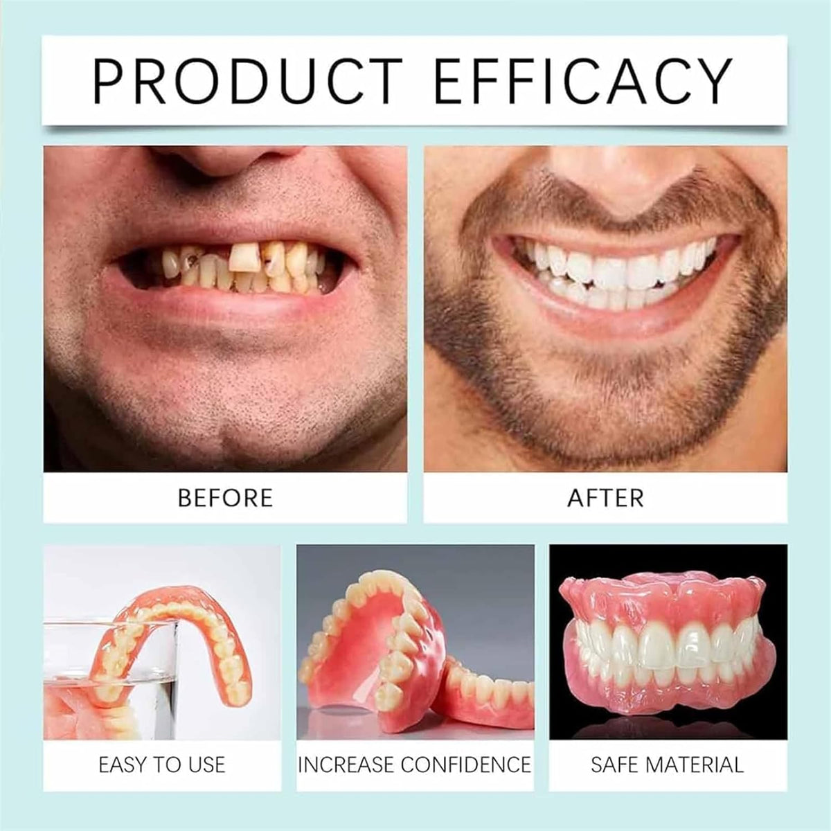 SmileGuard siliconen tandprothese