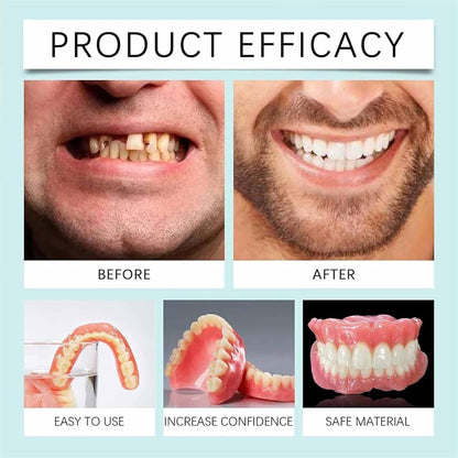SmileGuard siliconen tandprothese