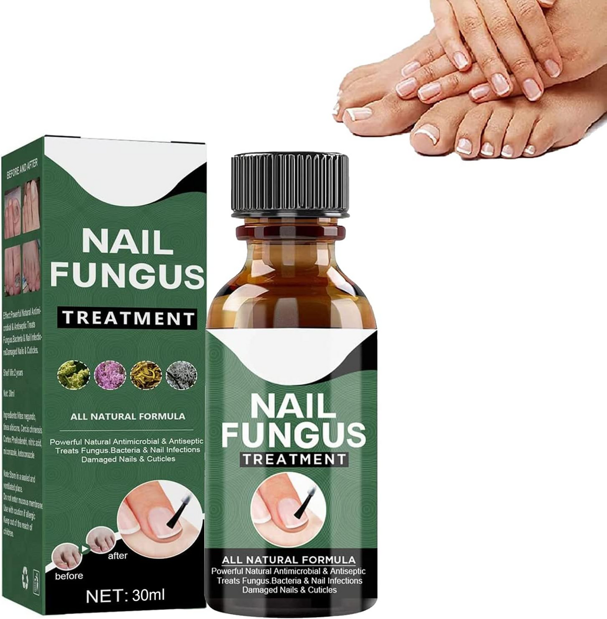 PureNail nagelschimmel behandeling serum