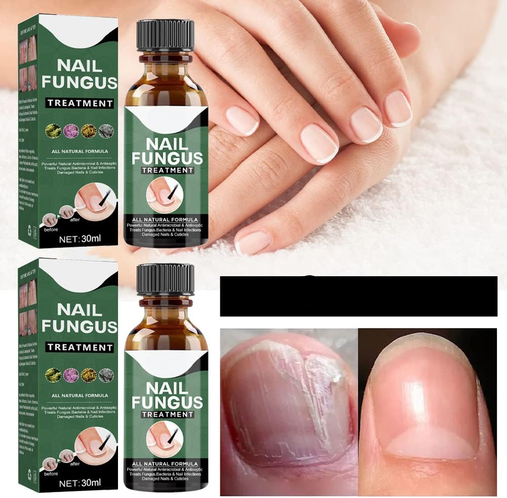 PureNail nagelschimmel behandeling serum
