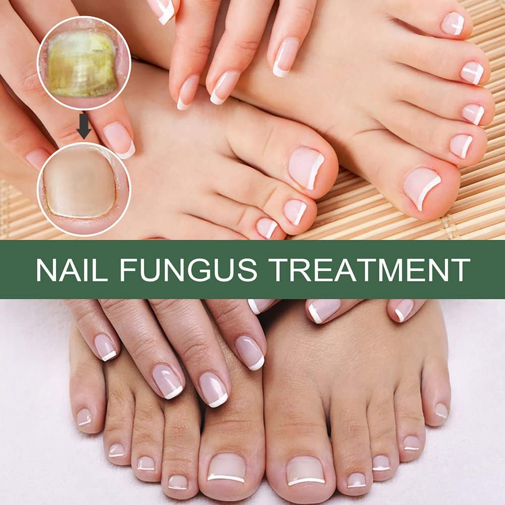 PureNail nagelschimmel behandeling serum