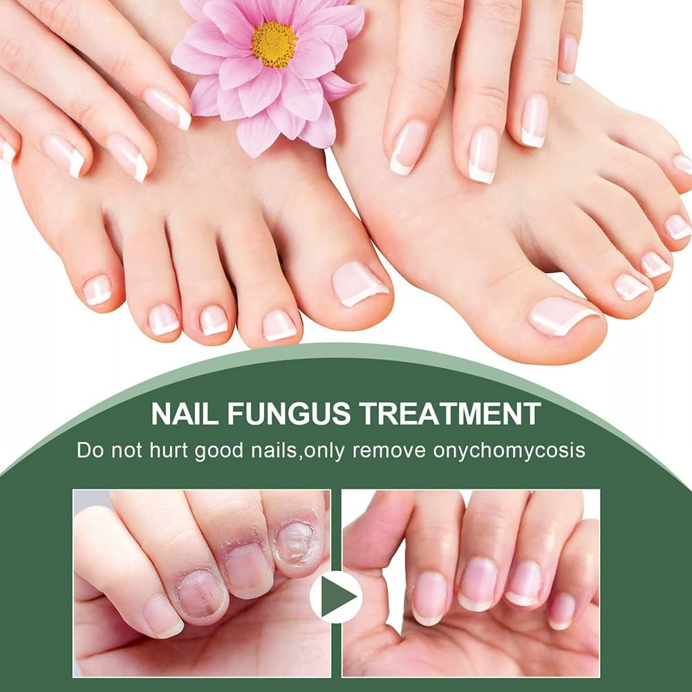 PureNail nagelschimmel behandeling serum