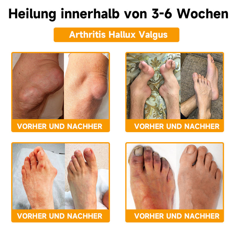 BeeLixir™ Bijengiftcrème met Hyaluronzuur en Collageen