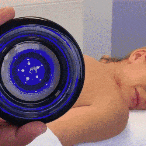 HealCupp draadloos cupping massageapparaat