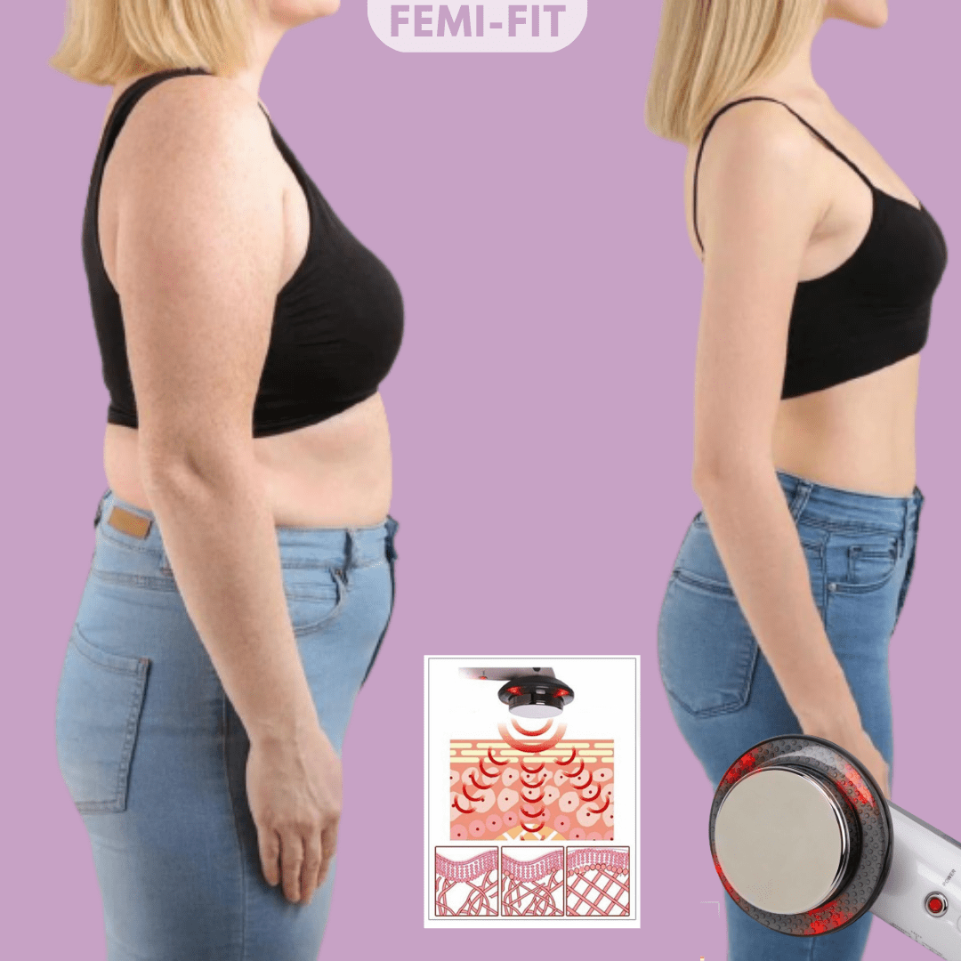 SLIMSHAPE 3-in-1 cellulitis- en vetverbrander