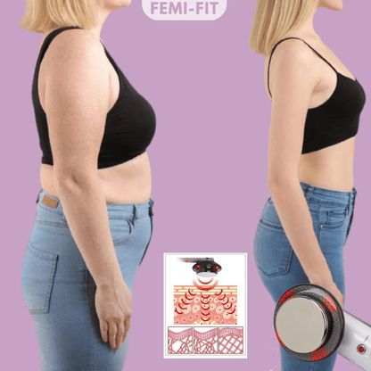 SLIMSHAPE 3-in-1 cellulitis- en vetverbrander