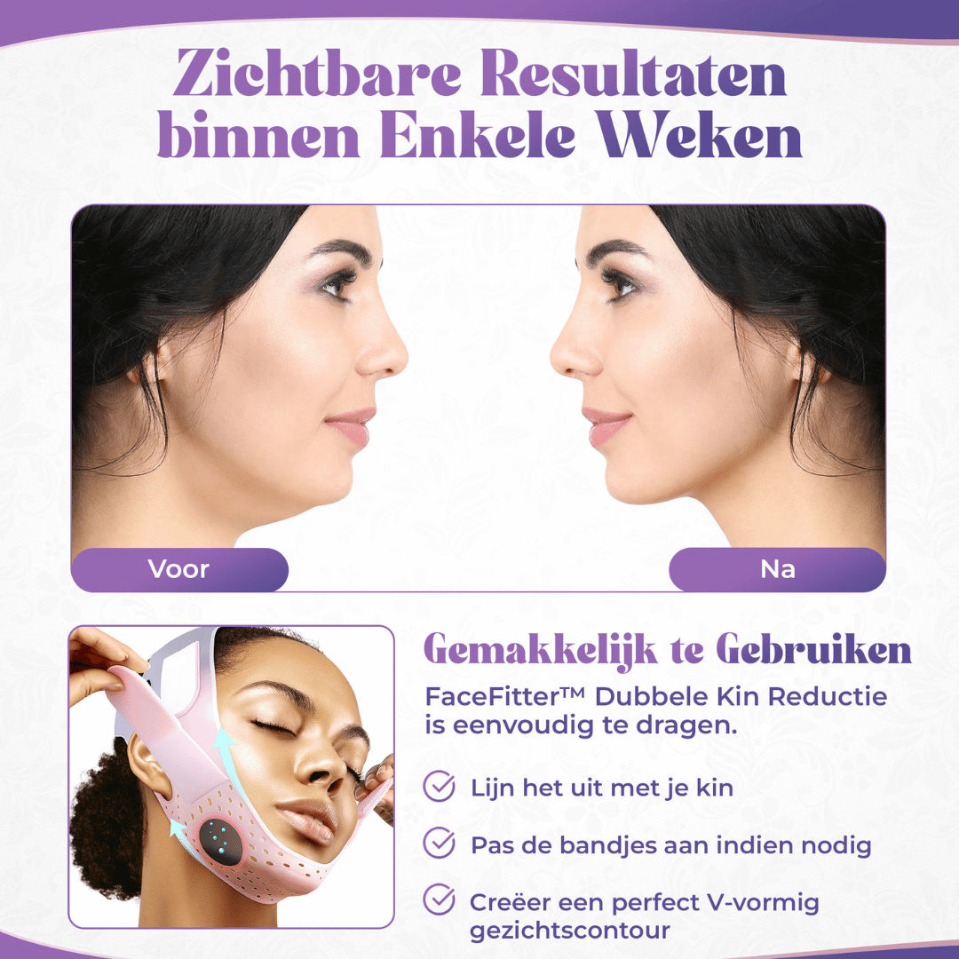FaceFitter dubbele kin reductie