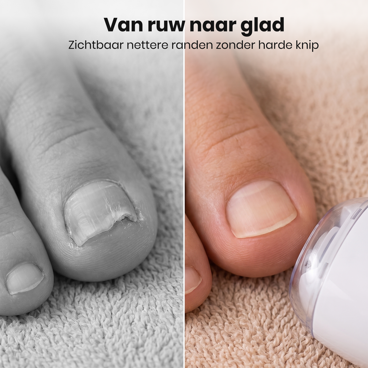 SanoNail elektrische nageltrimmer