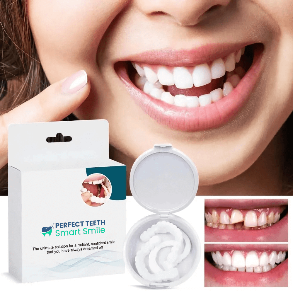Smart Smile cosmetisch gebit